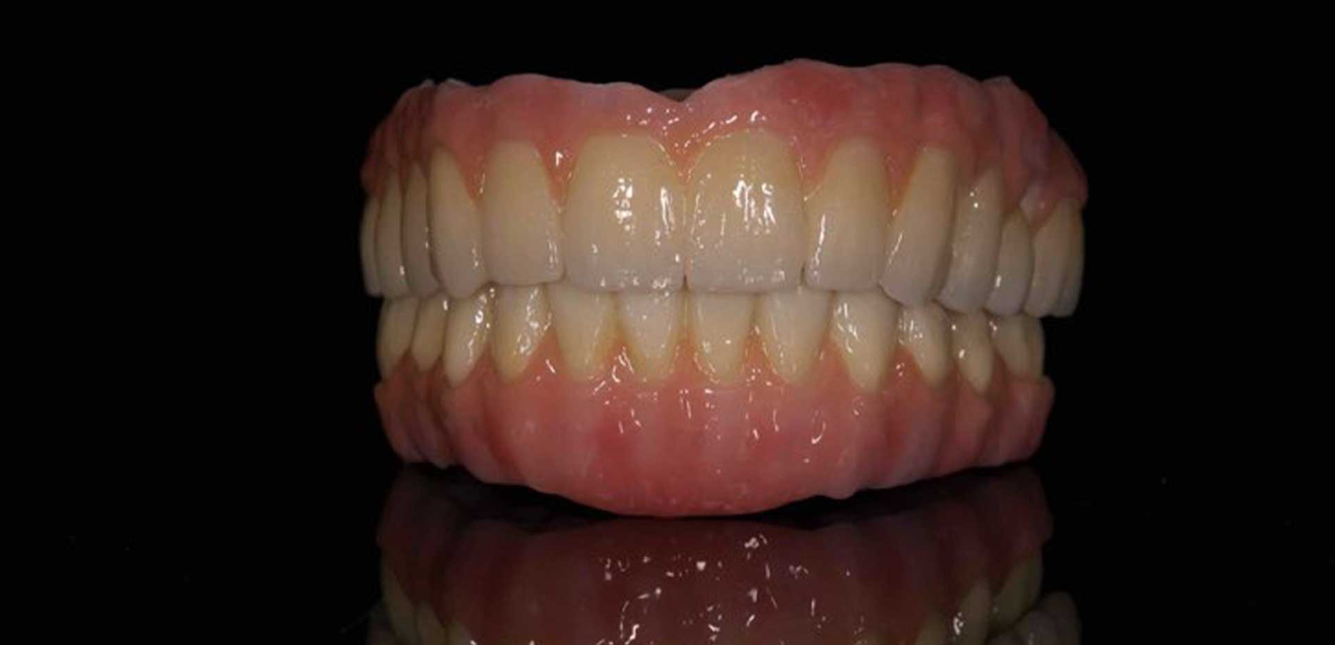 SmileDent Dental Studio | Acrylic Hybrid Solutions, nSequence reg  Protocol  and Implant Solutions