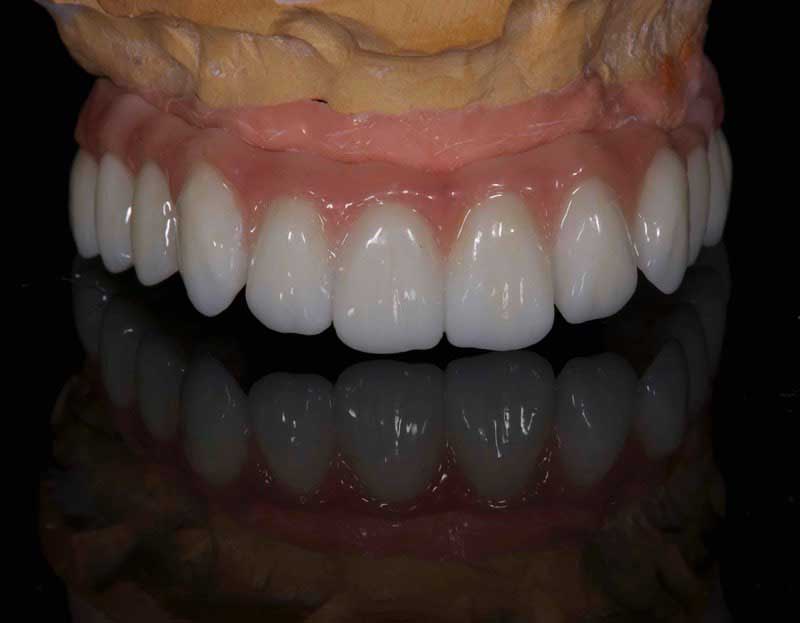 SmileDent Dental Studio | nSequence reg  Protocol , Implant Solutions and Surgical Guides