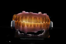 SmileDent Dental Studio | Aesthetic E-Max Solutions, PFM AND FCM Solutions and Implant Solutions