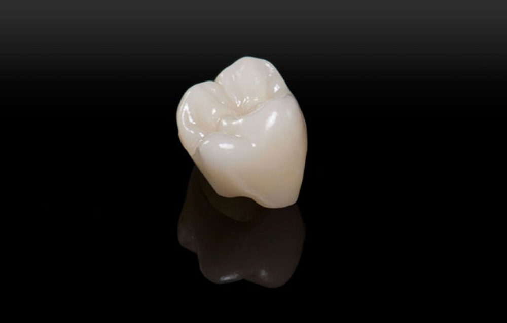 SmileDent Dental Studio | Acrylic Hybrid Solutions, Aesthetic E-Max Solutions and Implant Solutions